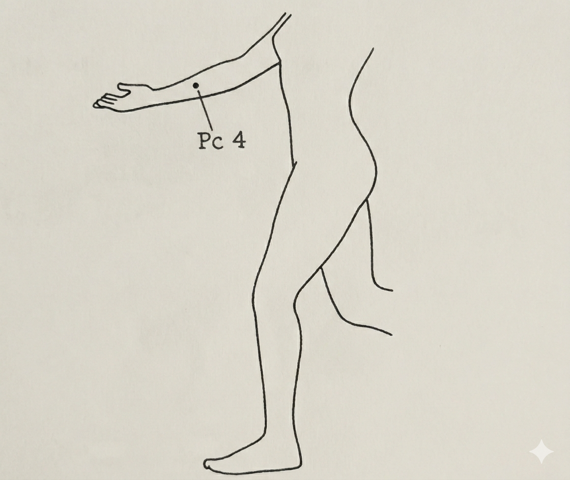 Pc 4 Cleft Gate pressure point location